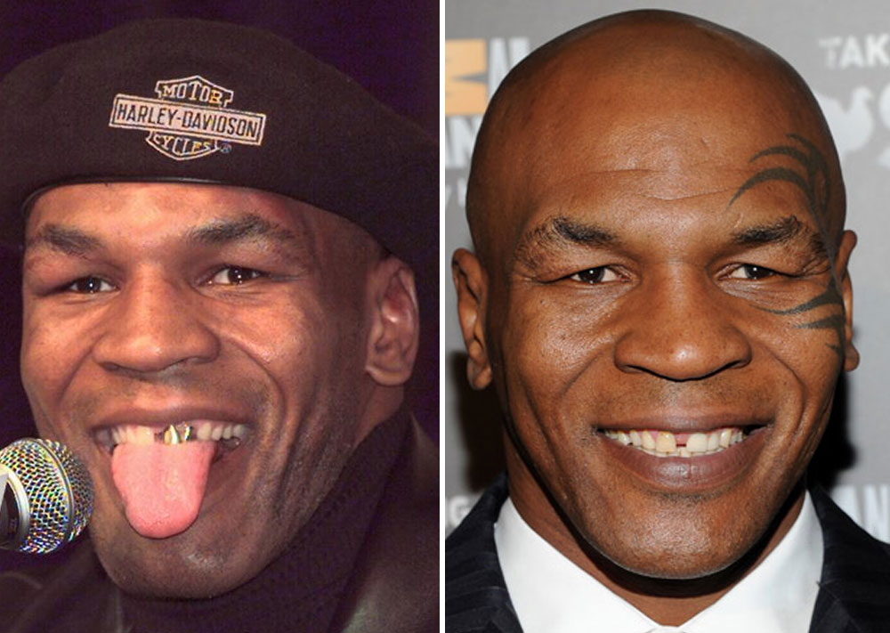 Mike Tyson