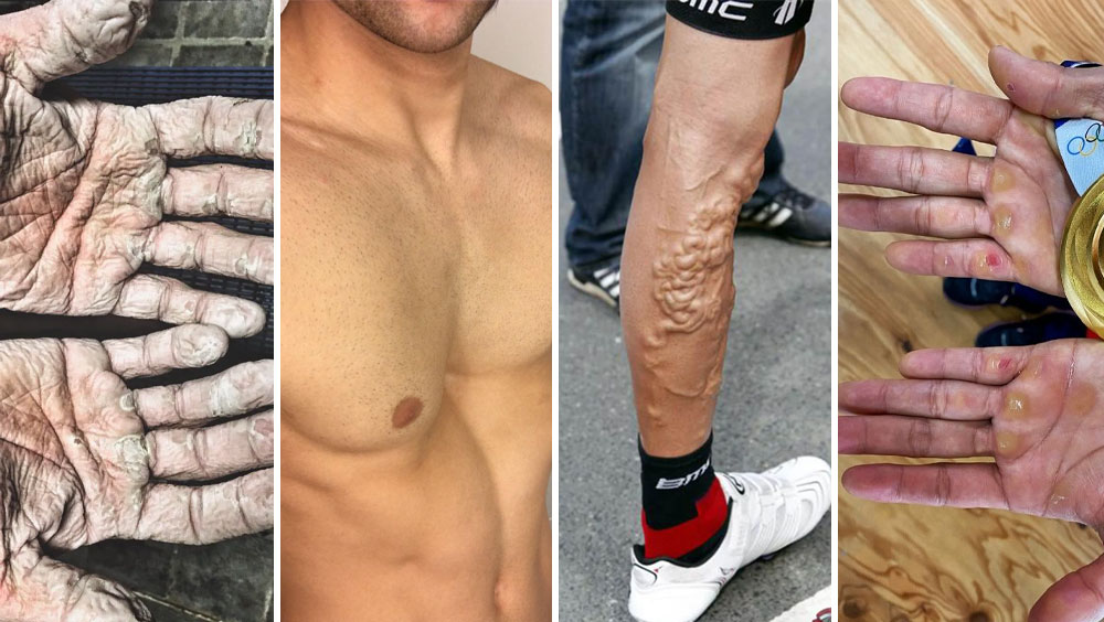 Freaky Photos Show What Elite Athletes Are Made Of